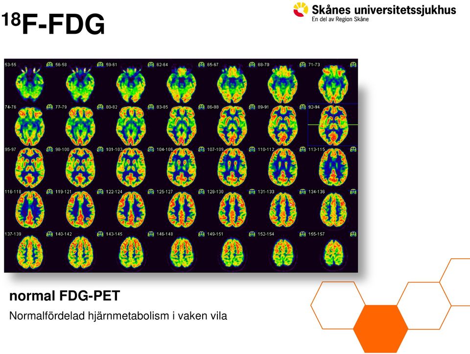 Normalfördelad