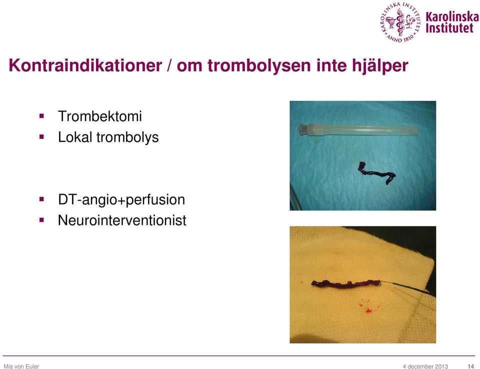 trombolys DT-angio+perfusion