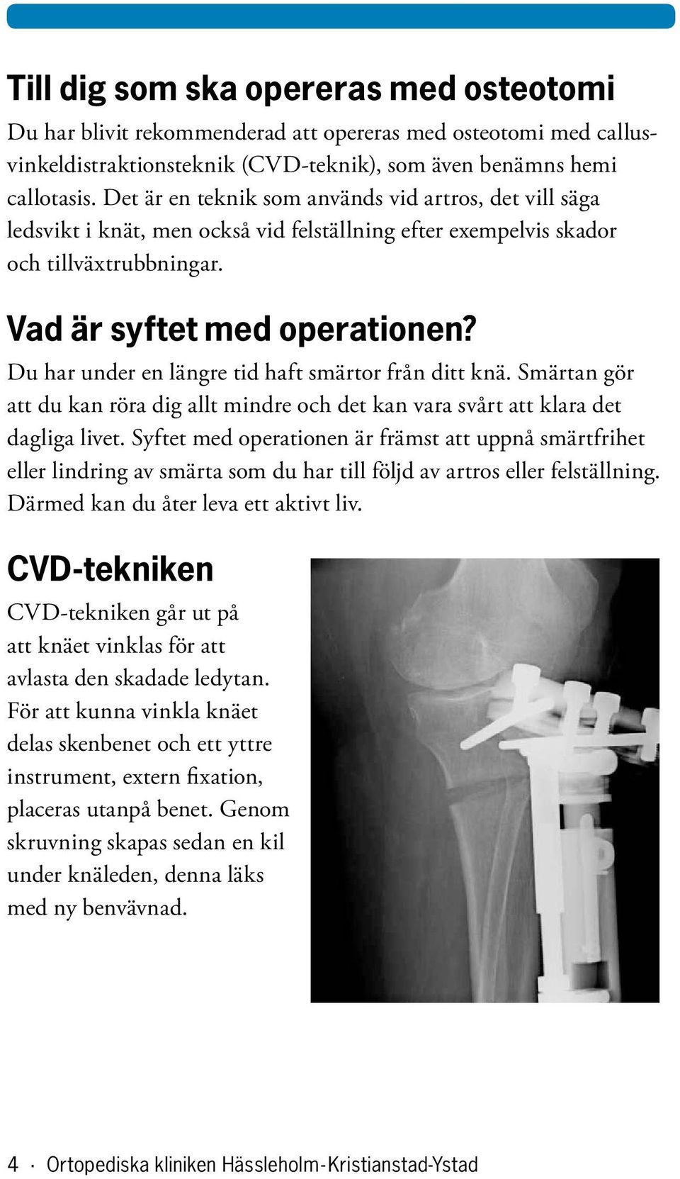 Du har under en längre tid haft smärtor från ditt knä. Smärtan gör att du kan röra dig allt mindre och det kan vara svårt att klara det dagliga livet.