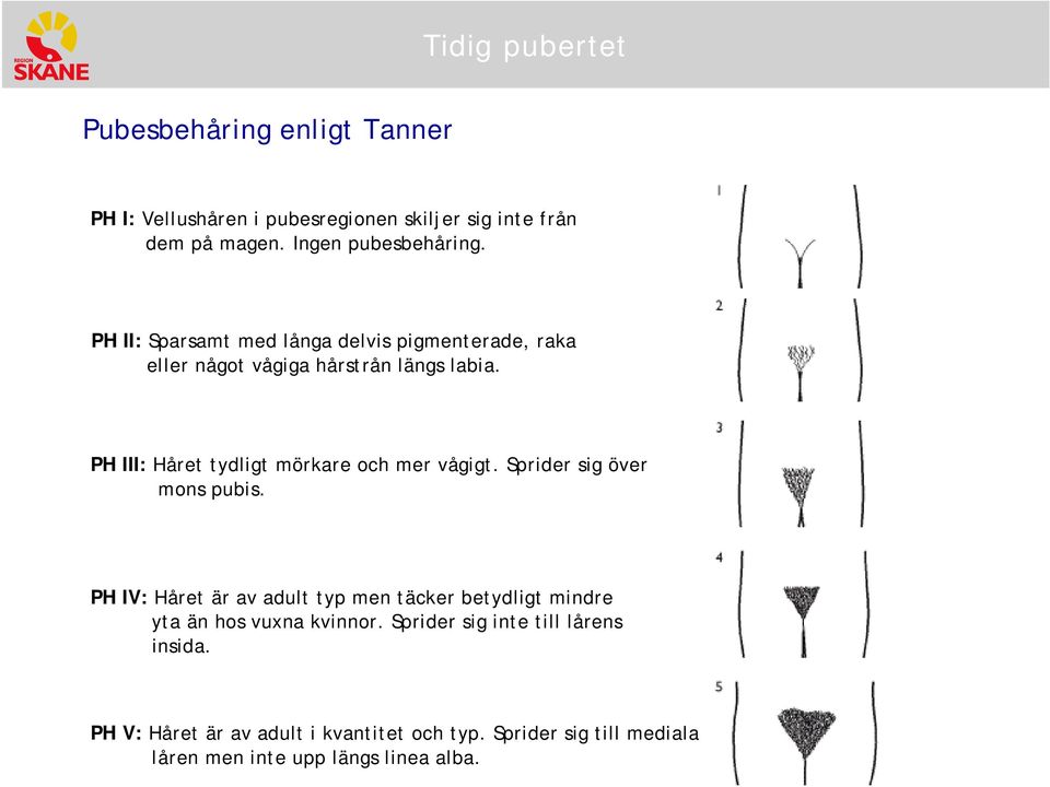 PH III: Håret tydligt mörkare ch mer vågigt. Sprider sig över mns pubis.