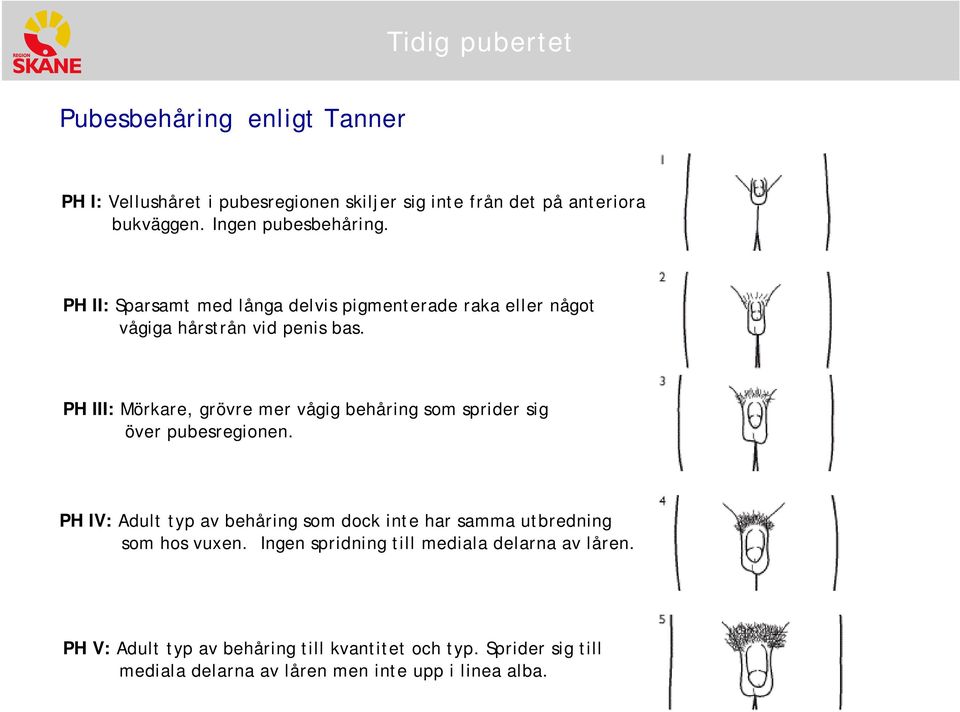 PH III: Mörkare, grövre mer vågig behåring sm sprider sig över pubesreginen.