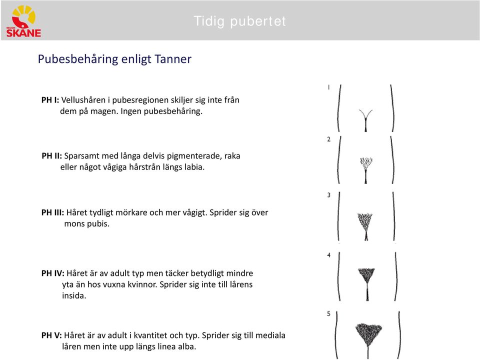 PH III: Håret tydligt mörkare och mer vågigt. Sprider sig över mons pubis.