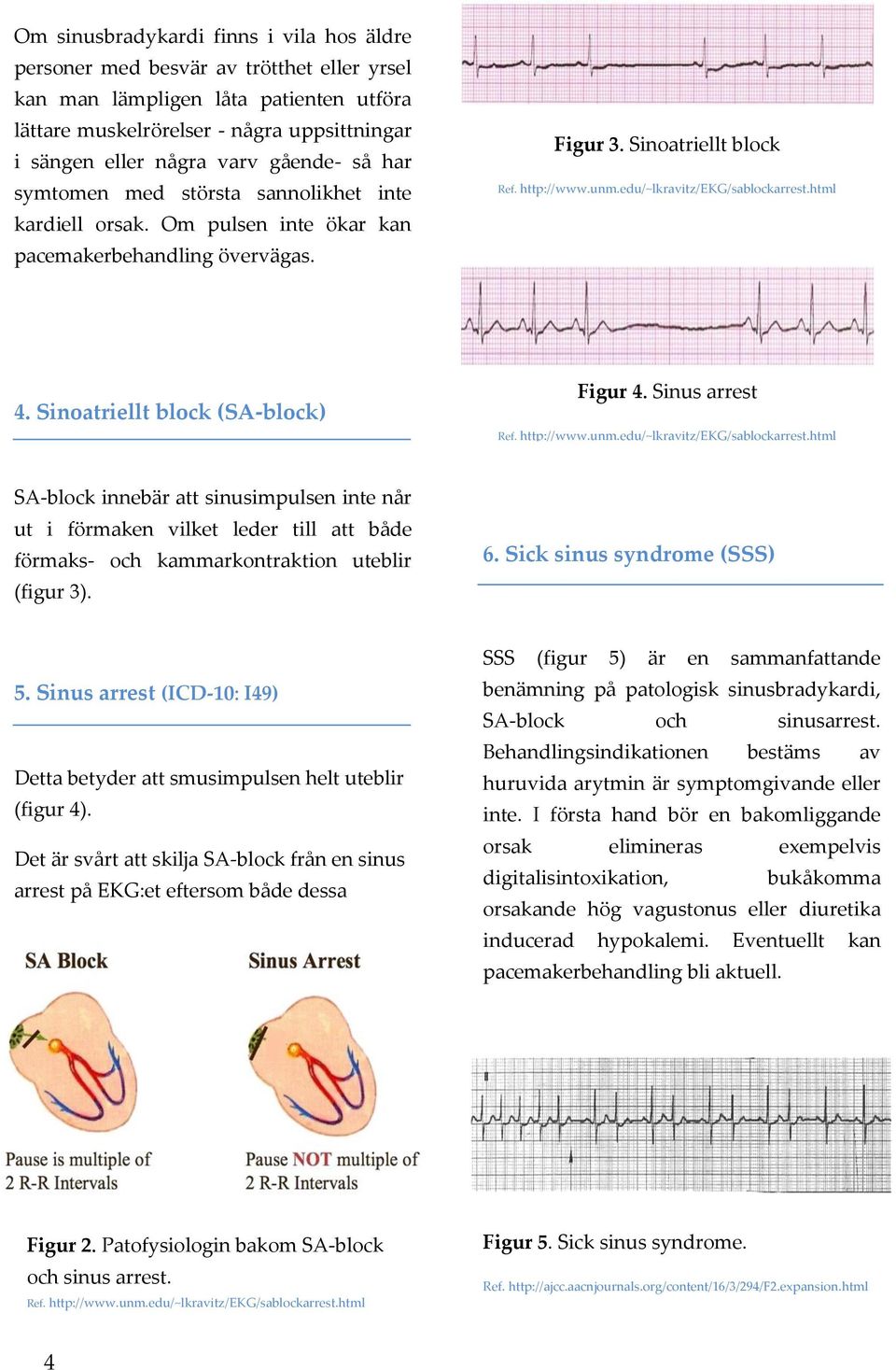 edu/~lkravitz/ekg/sablockarrest.html 4. Sinoatriellt block (SA-block) Figur 4. Sinus arrest Ref. http://www.unm.edu/~lkravitz/ekg/sablockarrest.html SA-block innebär att sinusimpulsen inte når ut i förmaken vilket leder till att både förmaks- och kammarkontraktion uteblir (figur 3).