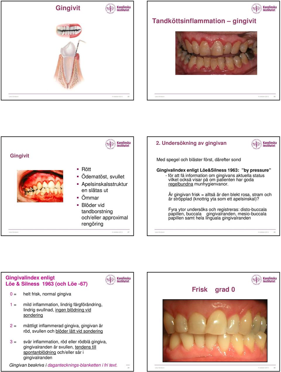 Gingivalindex enligt Löe&Silness 1963: by pressure - för att få information om gingivans aktuella status vilket också visar på om patienten har goda regelbundna munhygienvanor.