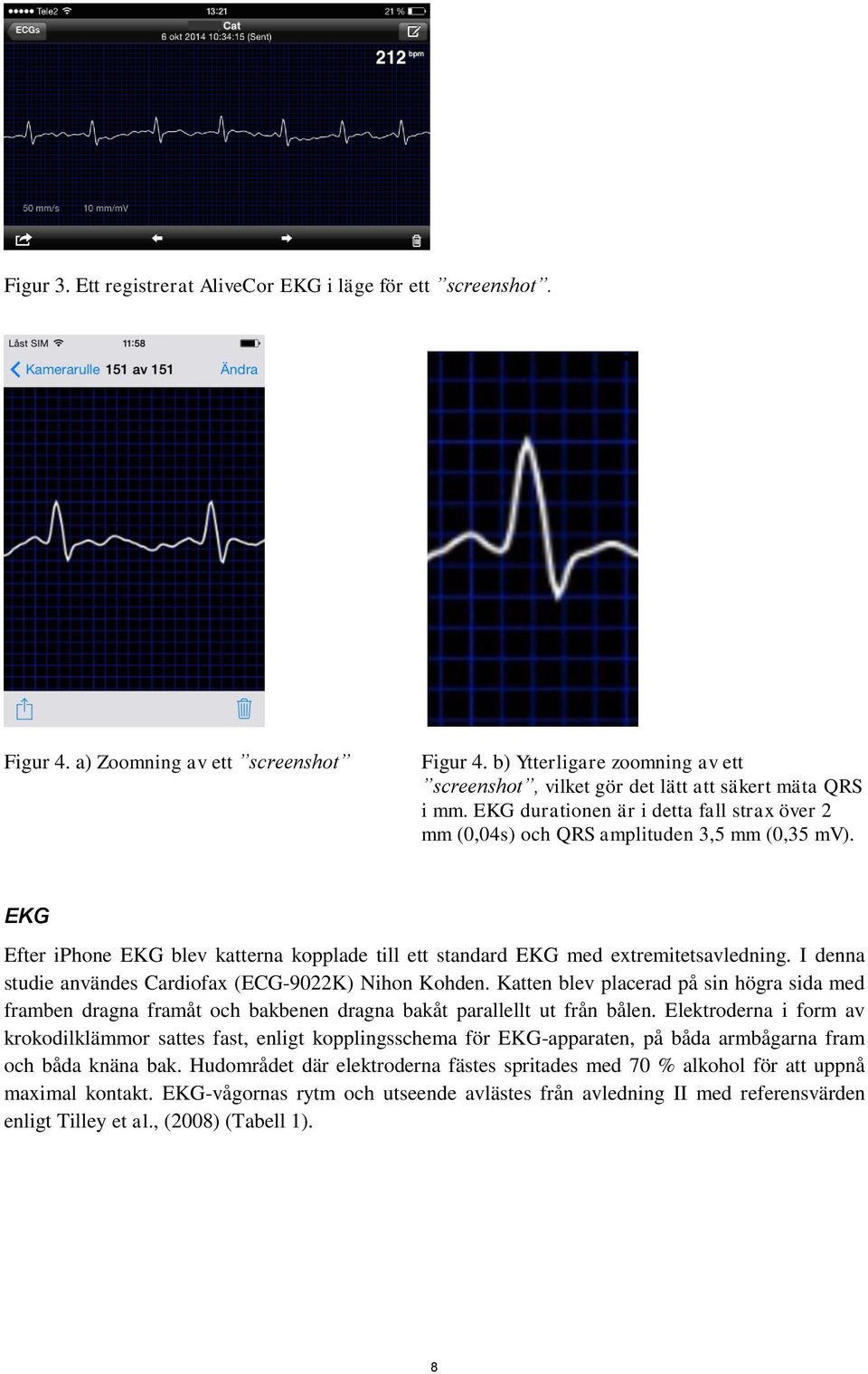 EKG Efter iphone EKG blev katterna kopplade till ett standard EKG med extremitetsavledning. I denna studie användes Cardiofax (ECG-9022K) Nihon Kohden.