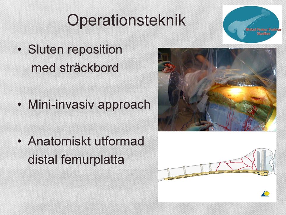 Mini-invasiv approach