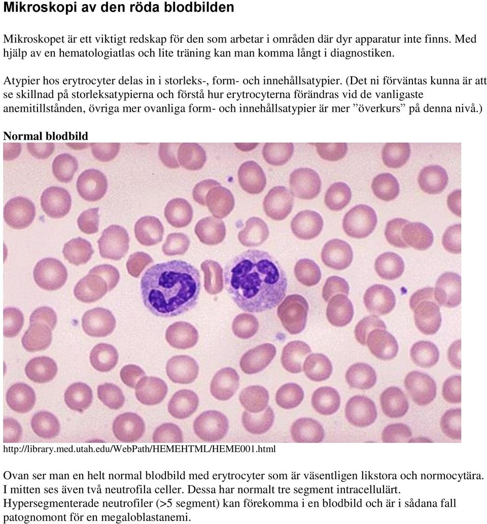 (Det ni förväntas kunna är att se skillnad på storleksatypierna och förstå hur erytrocyterna förändras vid de vanligaste anemitillstånden, övriga mer ovanliga form- och innehållsatypier är mer