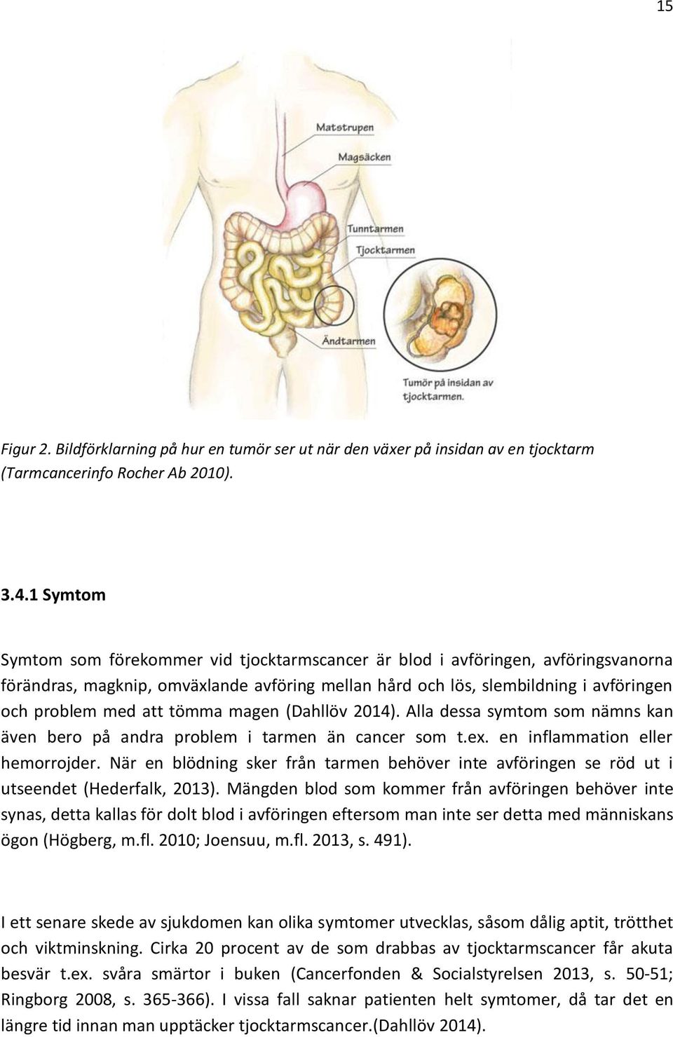 tömma magen (Dahllöv 2014). Alla dessa symtom som nämns kan även bero på andra problem i tarmen än cancer som t.ex. en inflammation eller hemorrojder.