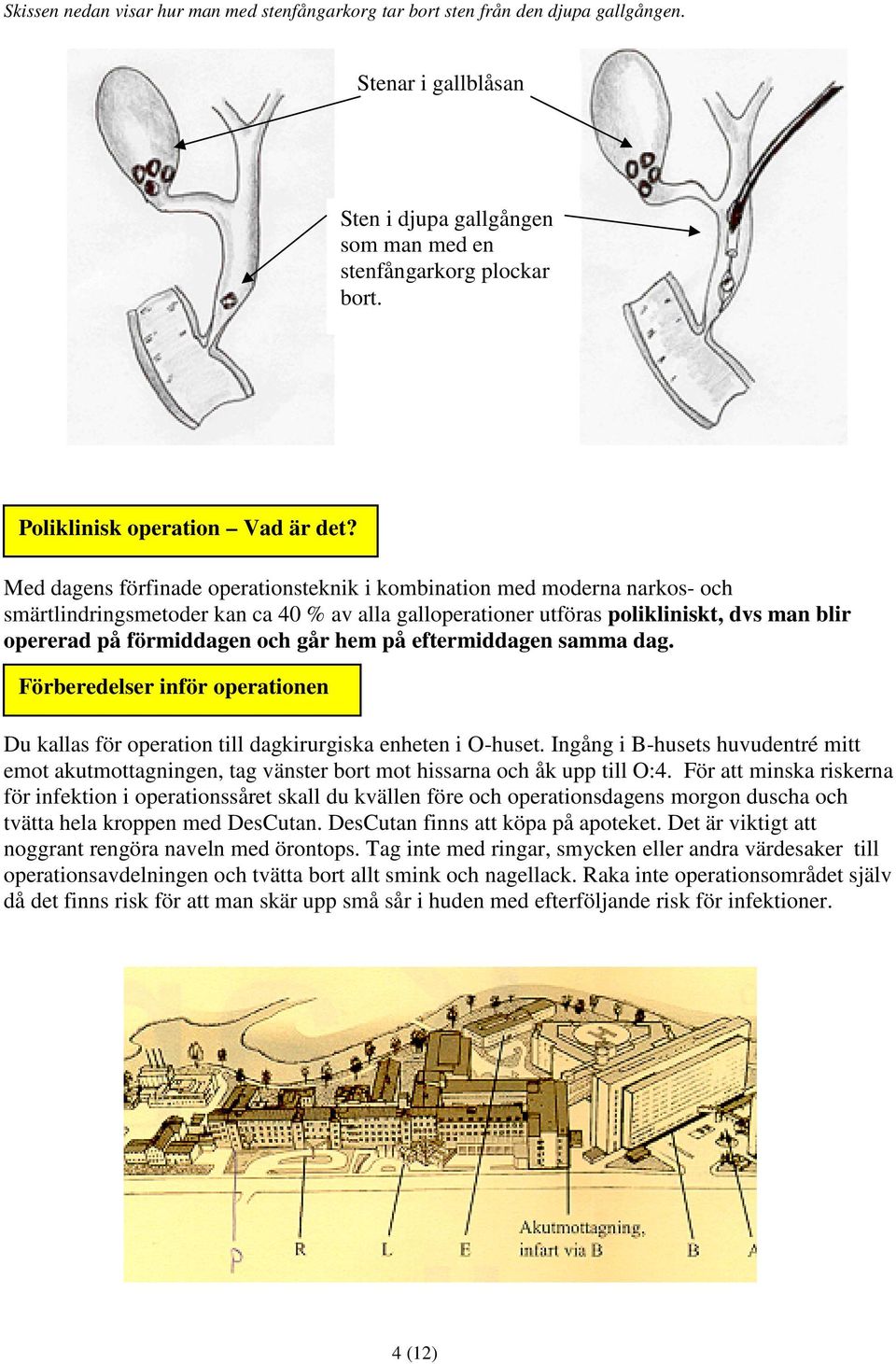 Med dagens förfinade operationsteknik i kombination med moderna narkos- och smärtlindringsmetoder kan ca 40 % av alla galloperationer utföras polikliniskt, dvs man blir opererad på förmiddagen och