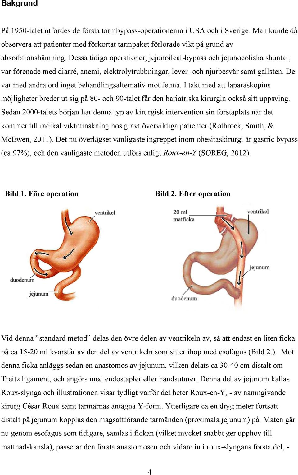 De var med andra ord inget behandlingsalternativ mot fetma. I takt med att laparaskopins möjligheter breder ut sig på 80- och 90-talet får den bariatriska kirurgin också sitt uppsving.