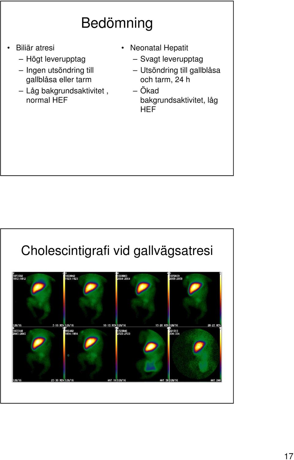 Hepatit Svagt leverupptag Utsöndring till gallblåsa och tarm, 24 h