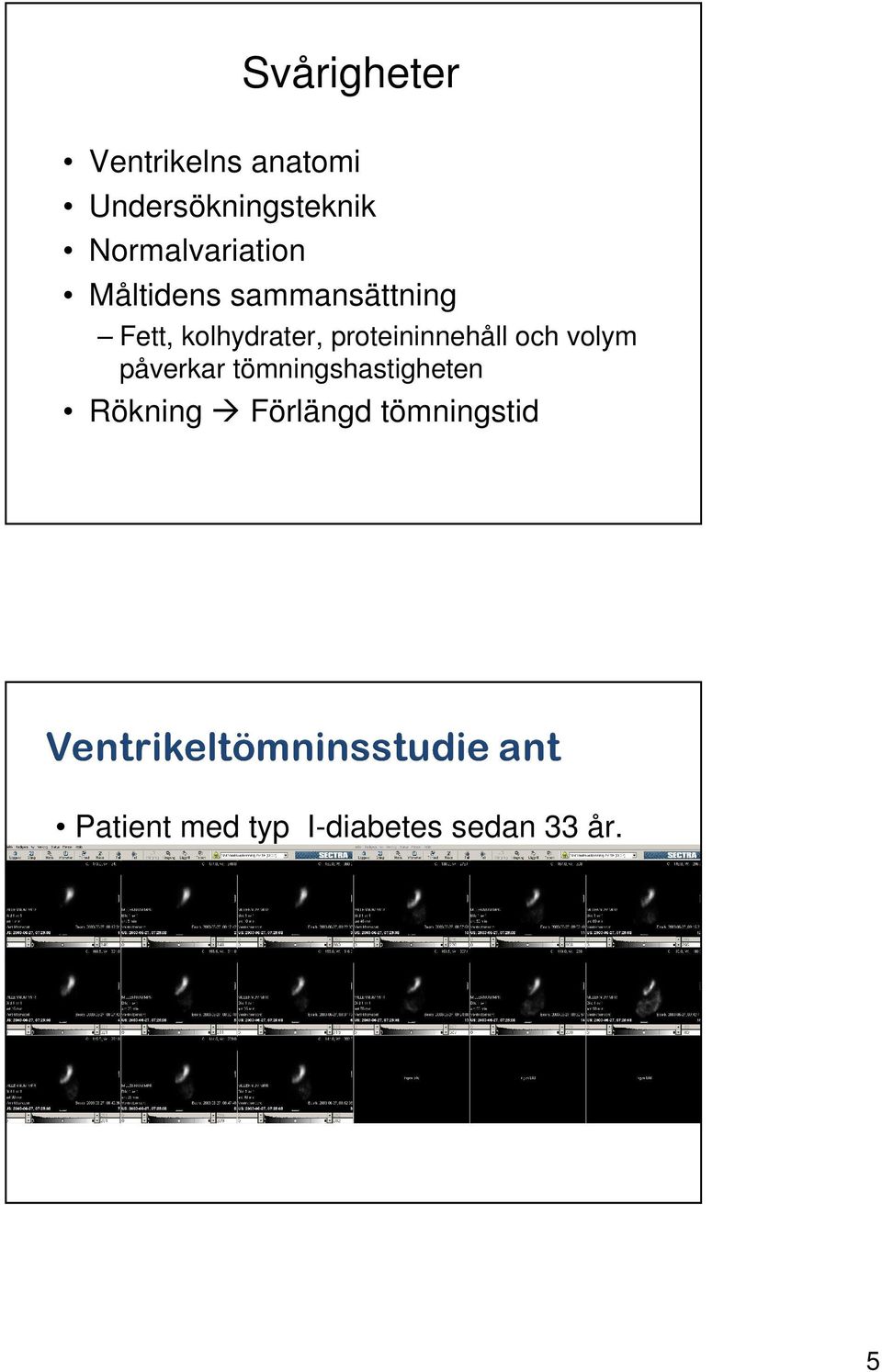 Rökning Förlängd tömningstid Patient med typ I-diabetes sedan 33 år. CABG-opererad.