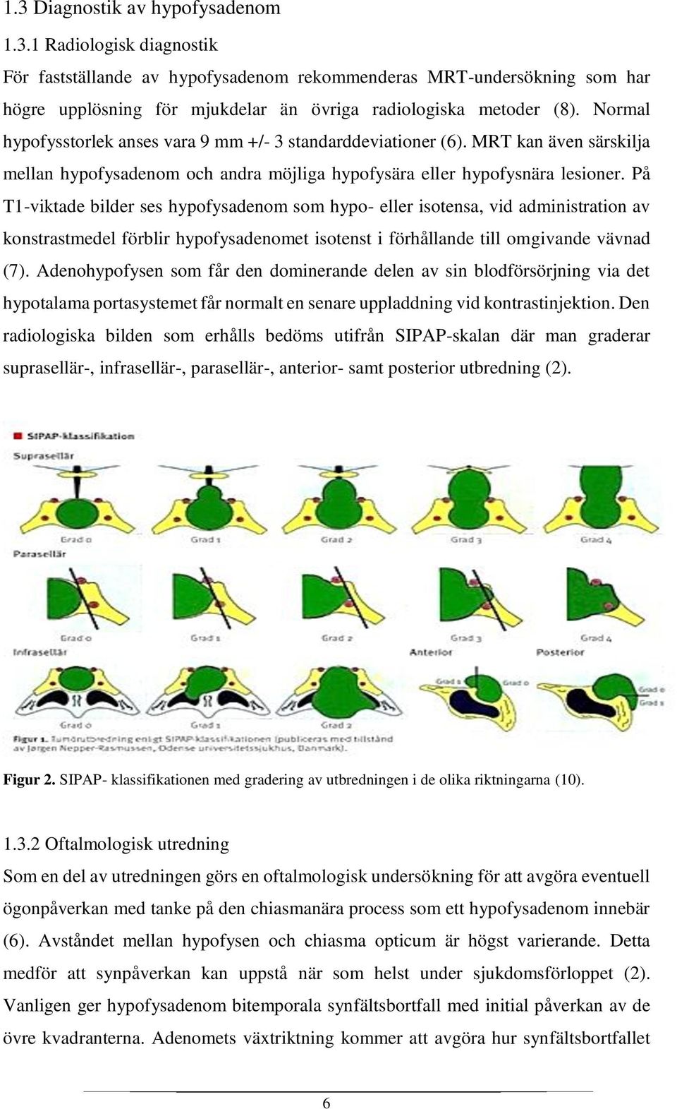 På T1-viktade bilder ses hypofysadenom som hypo- eller isotensa, vid administration av konstrastmedel förblir hypofysadenomet isotenst i förhållande till omgivande vävnad (7).