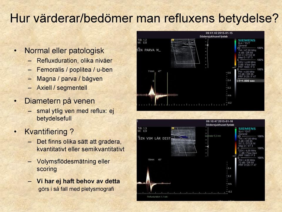 bågven Axiell / segmentell Diametern på venen smal ytlig ven med reflux: ej betydelsefull Kvantifiering?