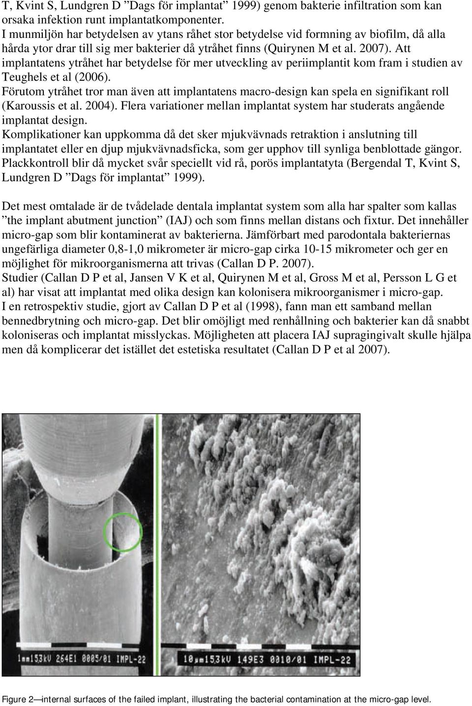 Att implantatens ytråhet har betydelse för mer utveckling av periimplantit kom fram i studien av Teughels et al (2006).