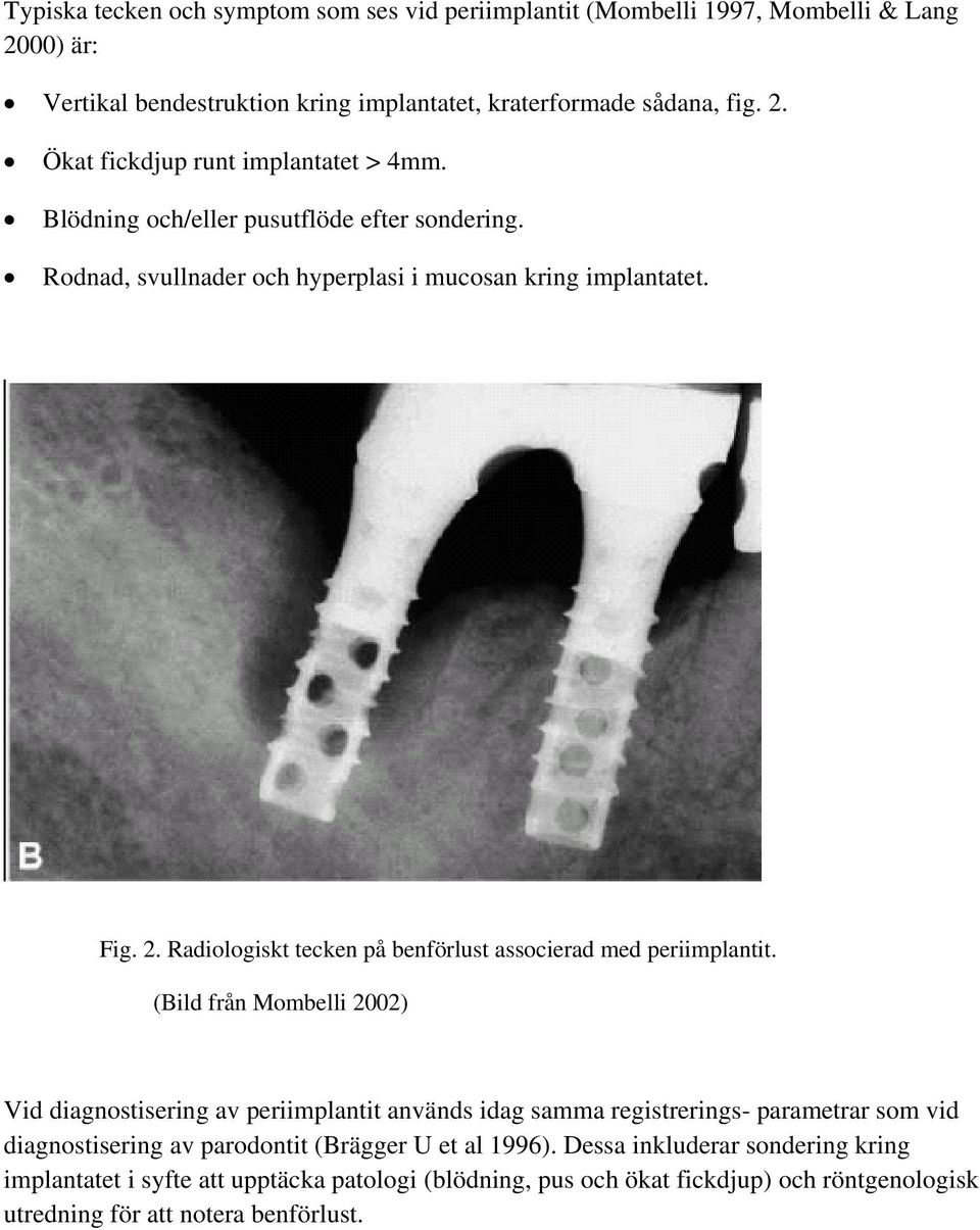 (Bild från Mombelli 2002) Vid diagnostisering av periimplantit används idag samma registrerings- parametrar som vid diagnostisering av parodontit (Brägger U et al 1996).