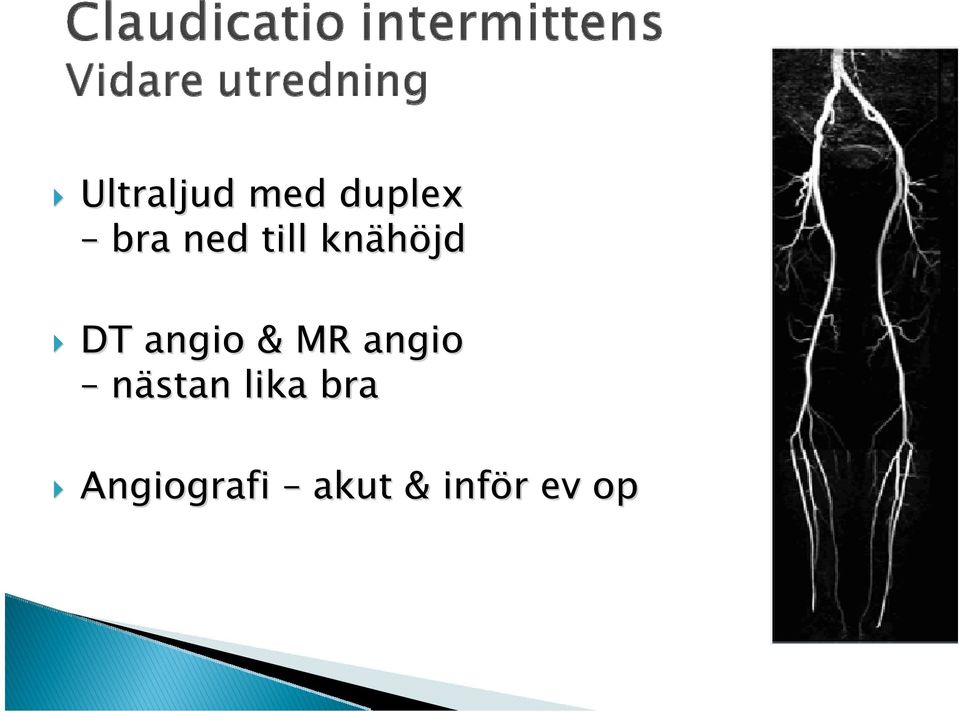 & MR angio nästan lika bra