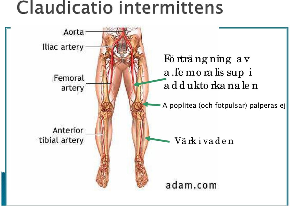 adduktorkanalen A