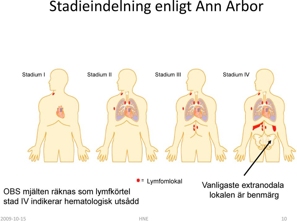 lymfkörtel stad IV indikerar hematologisk utsådd