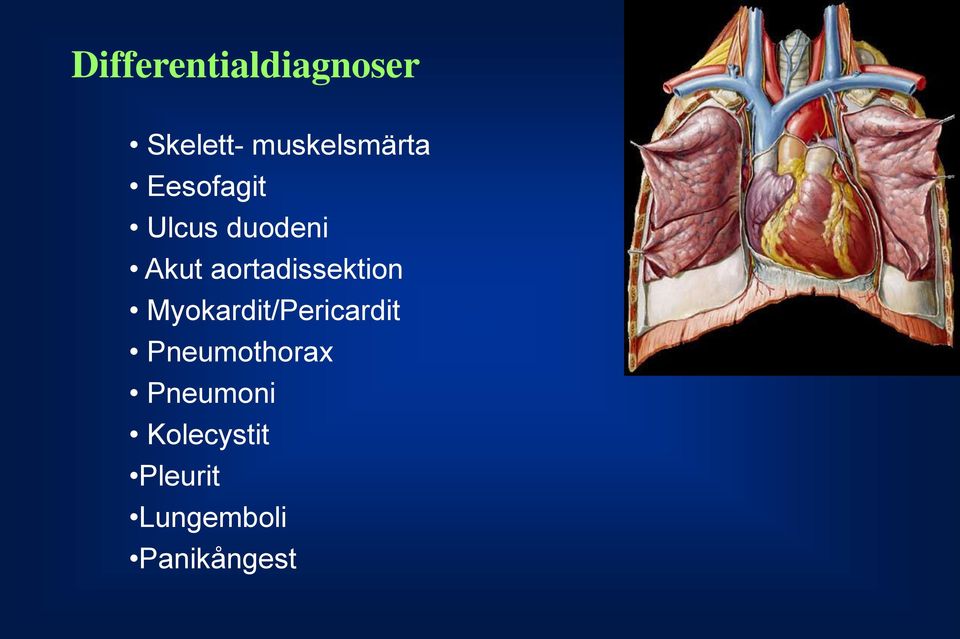 aortadissektion Myokardit/Pericardit