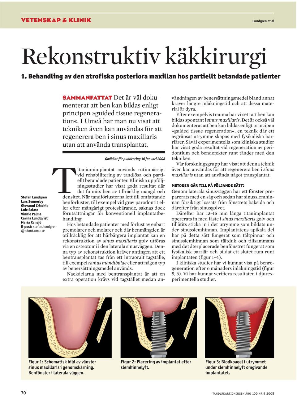 lundgren @odont.umu.se sammanfattat Det är väl dokumenterat att ben kan bildas enligt principen»guided tissue regeneration«.