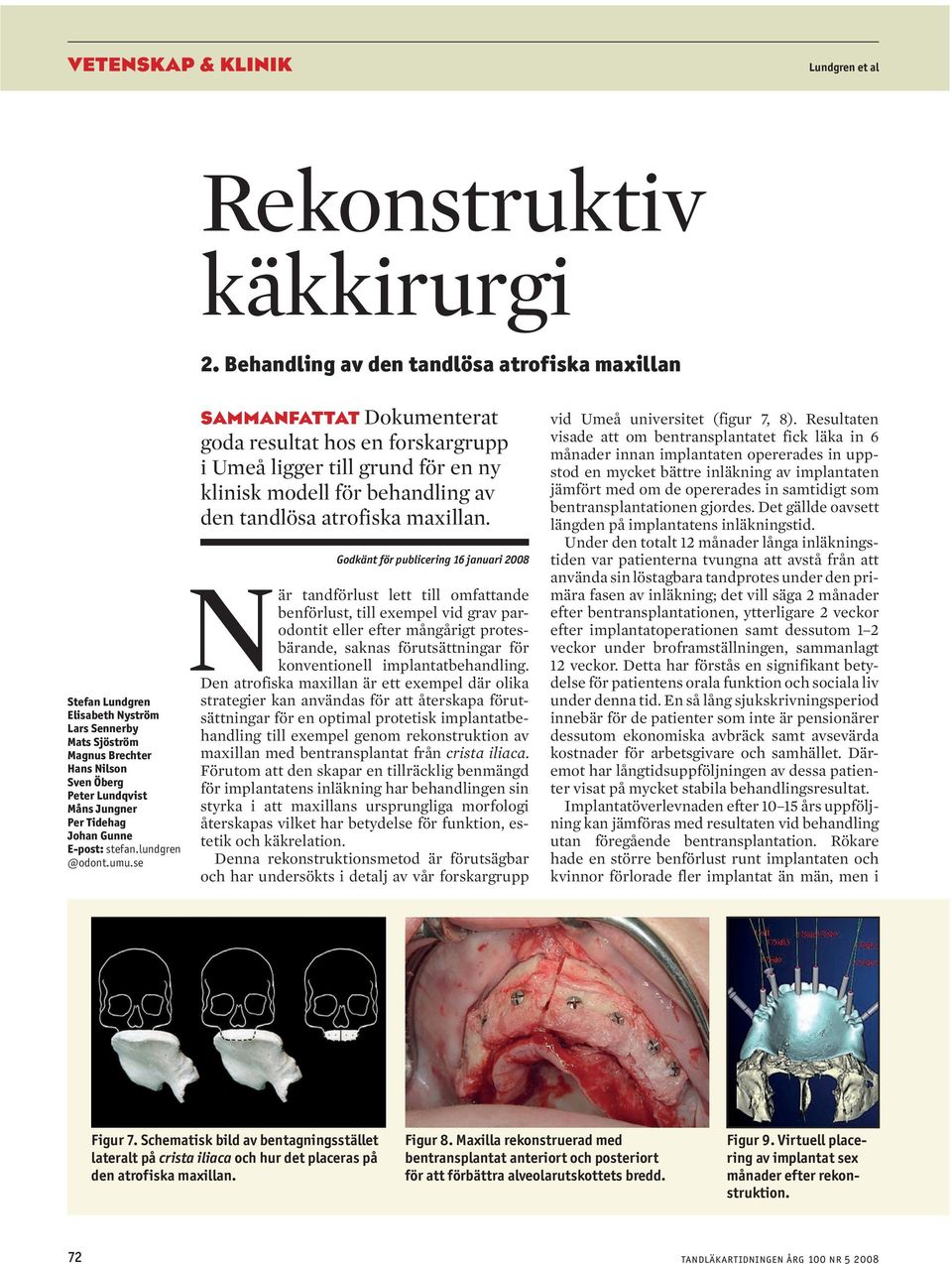 E-post: stefan.lundgren @odont.umu.se sammanfattat Dokumenterat goda resultat hos en forskargrupp i Umeå ligger till grund för en ny klinisk modell för behandling av den tandlösa atrofiska maxillan.