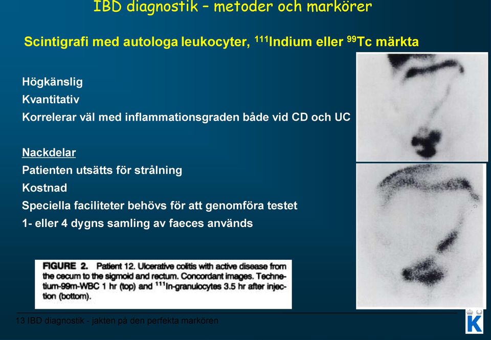 Nackdelar Patienten utsätts för strålning Kostnad Speciella faciliteter behövs för att