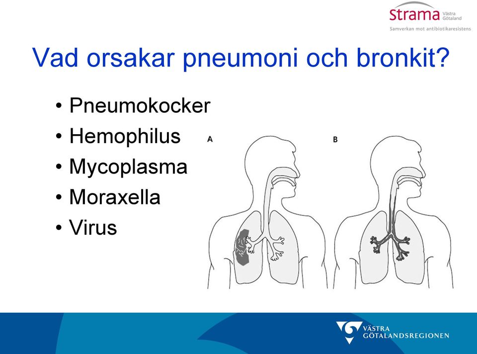 Pneumokocker