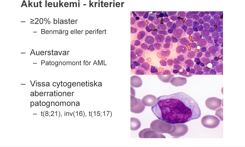 Patognomont för AML Vissa cytogenetiska