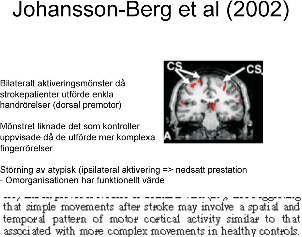 kontroller uppvisade då de utförde mer komplexa fingerrörelser Störning av