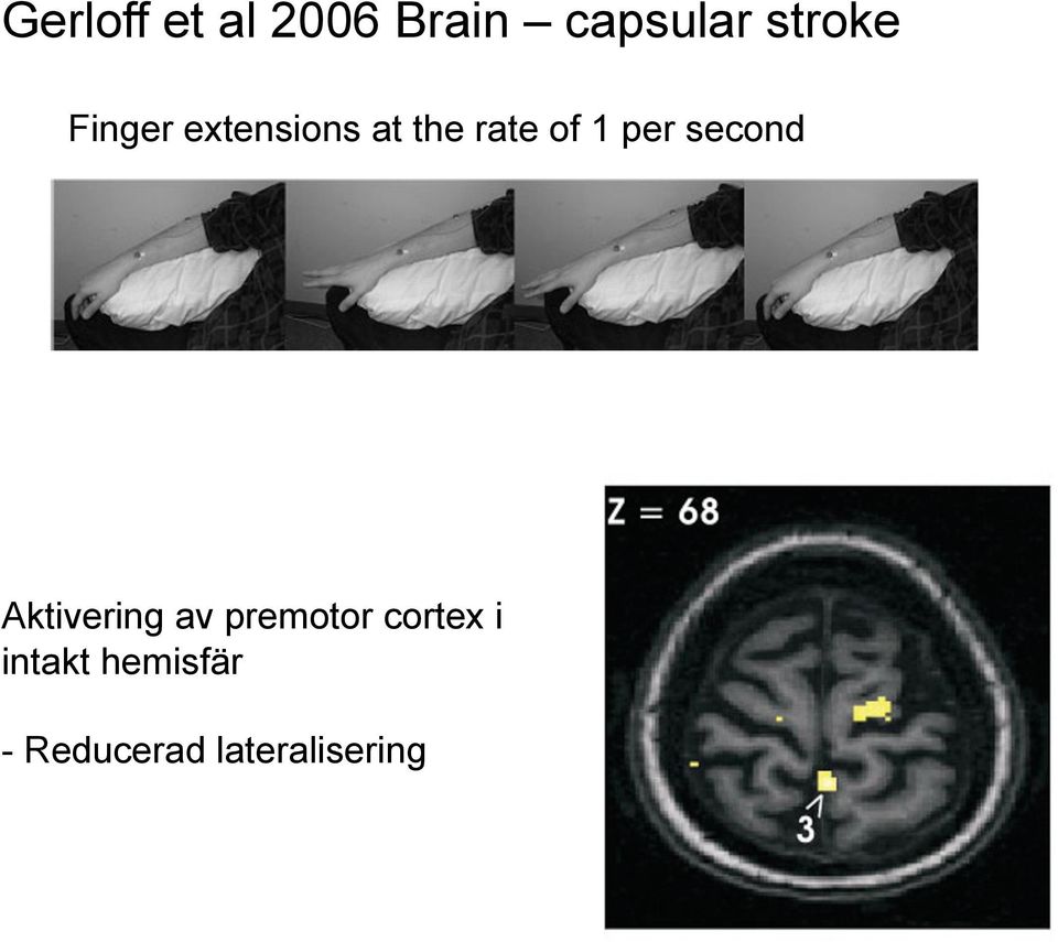 second Aktivering av premotor cortex i