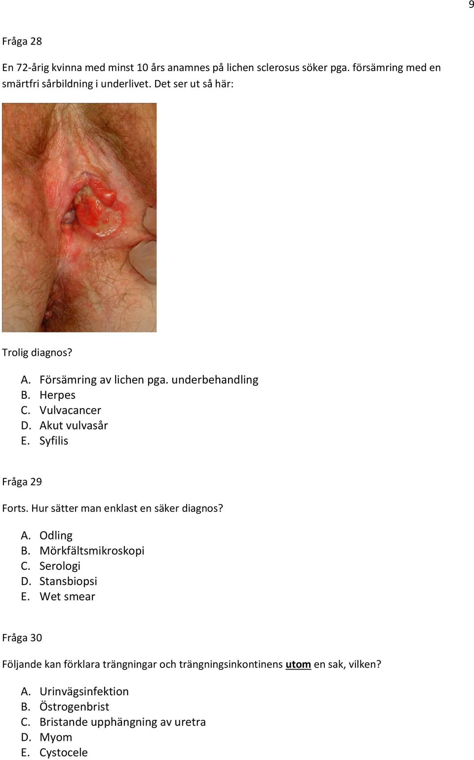 Syfilis Fråga 29 Forts. Hur sätter man enklast en säker diagnos? A. Odling B. Mörkfältsmikroskopi C. Serologi D. Stansbiopsi E.