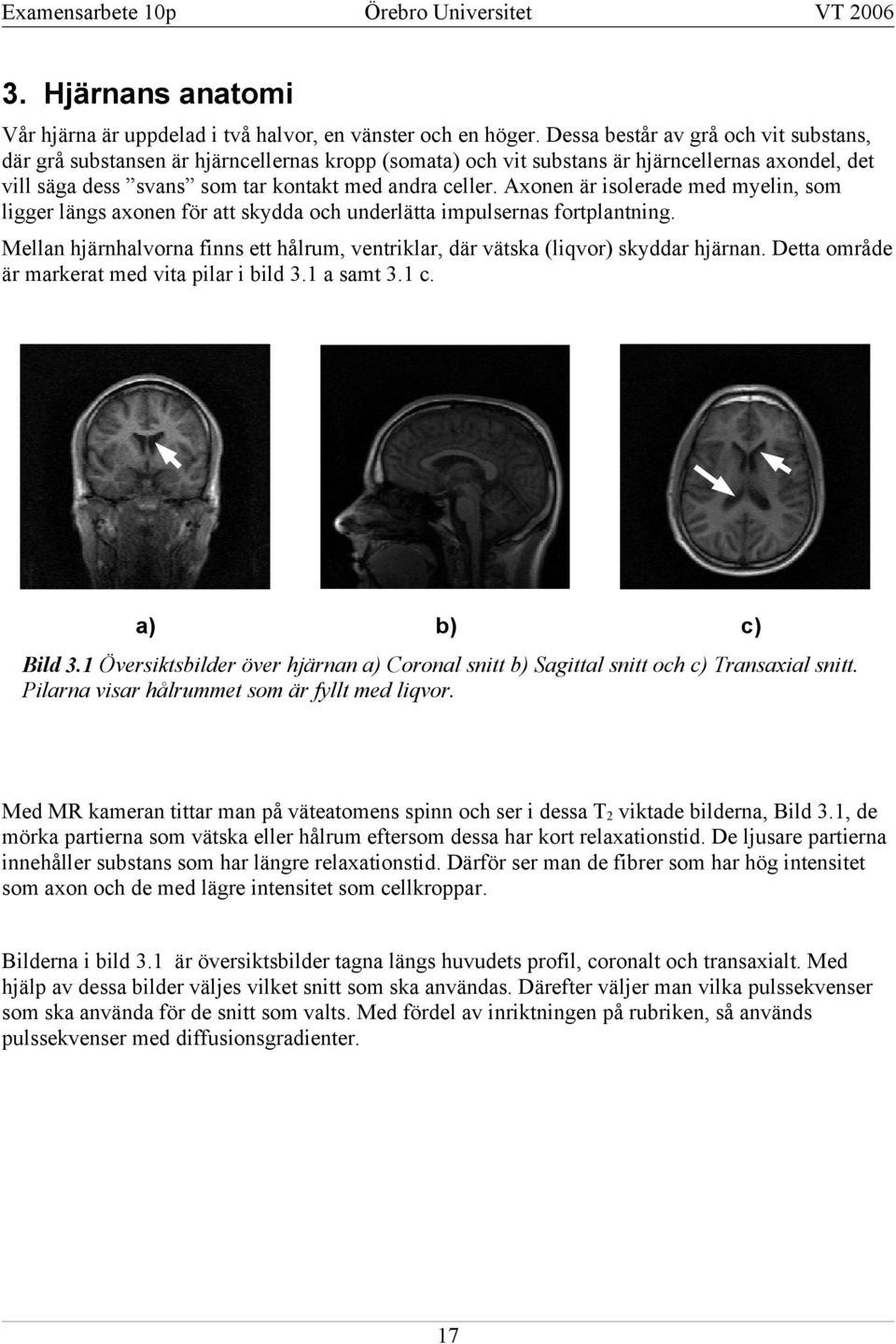 Axonen är isolerade med myelin, som ligger längs axonen för att skydda och underlätta impulsernas fortplantning. Mellan hjärnhalvorna finns ett hålrum, ventriklar, där vätska (liqvor) skyddar hjärnan.