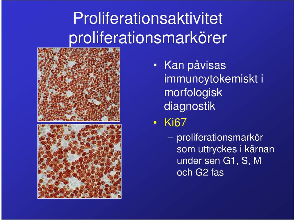 immuncytokemiskt i morfologisk diagnostik