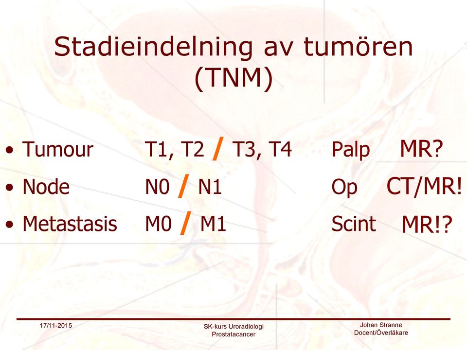 Palp Node N0 / N1 Op