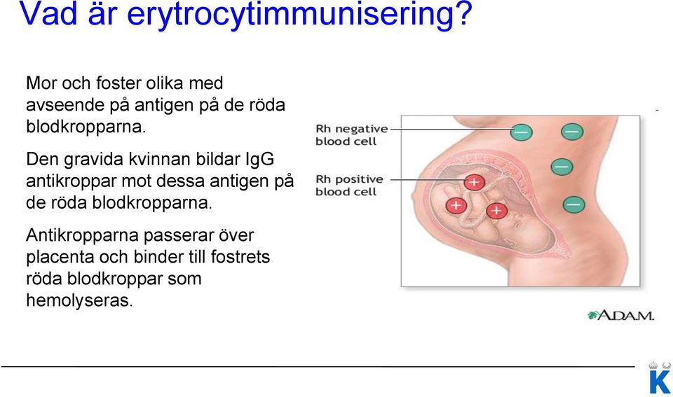 Den gravida kvinnan bildar IgG antikroppar mot dessa antigen på de