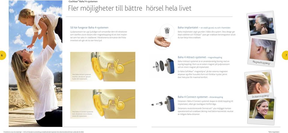 Baha-implantatet en stabil grund, nu och i framtiden Baha-implantatet utgör grunden i båda våra system.