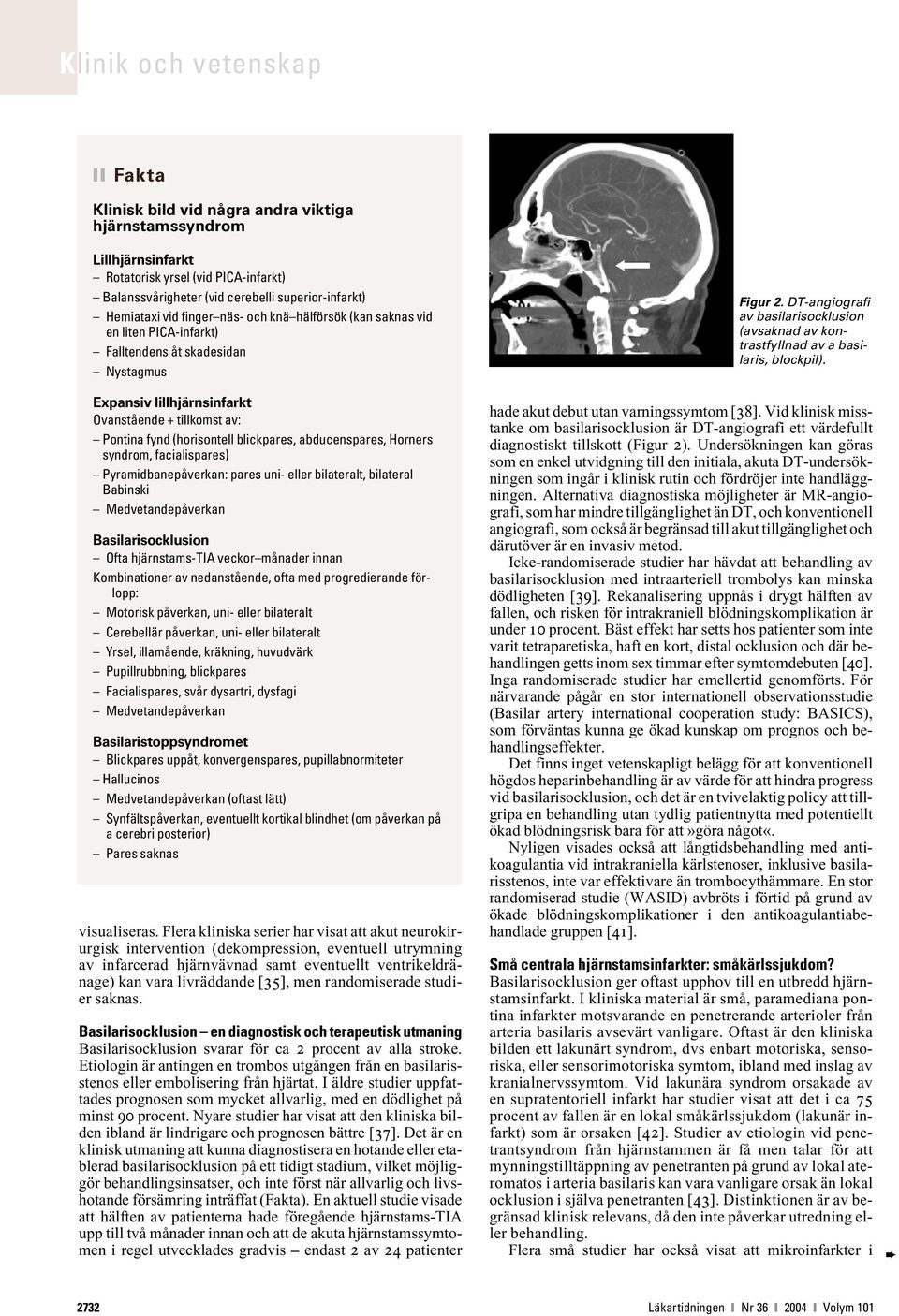 Horners syndrom, facialispares) Pyramidbanepåverkan: pares uni- eller bilateralt, bilateral Babinski Medvetandepåverkan Basilarisocklusion Ofta hjärnstams-tia veckor månader innan Kombinationer av