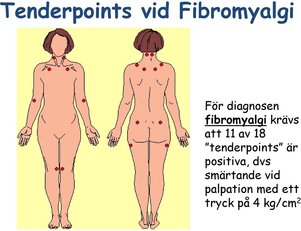 18 tenderpoints är positiva, dvs
