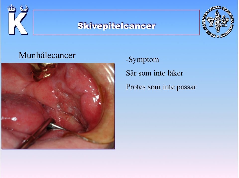 -Symptom Sår som