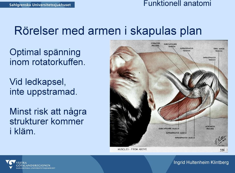 Vid ledkapsel, inte uppstramad.