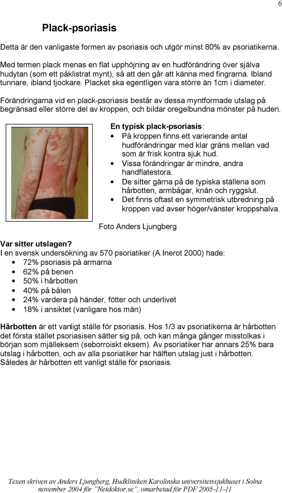 Placket ska egentligen vara större än 1cm i diameter.