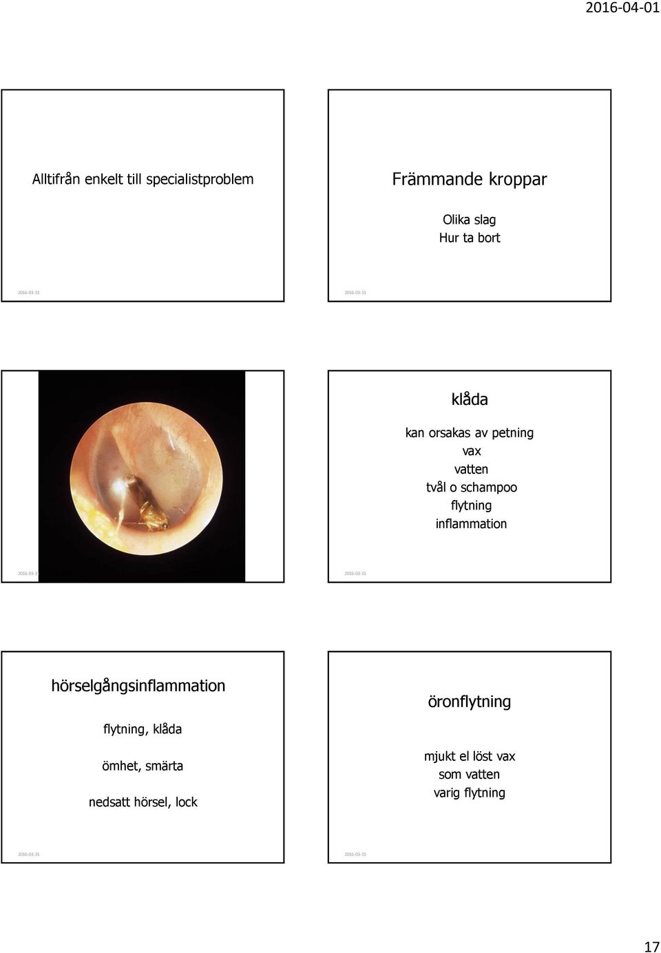 inflammation hörselgångsinflammation öronflytning flytning, klåda ömhet,