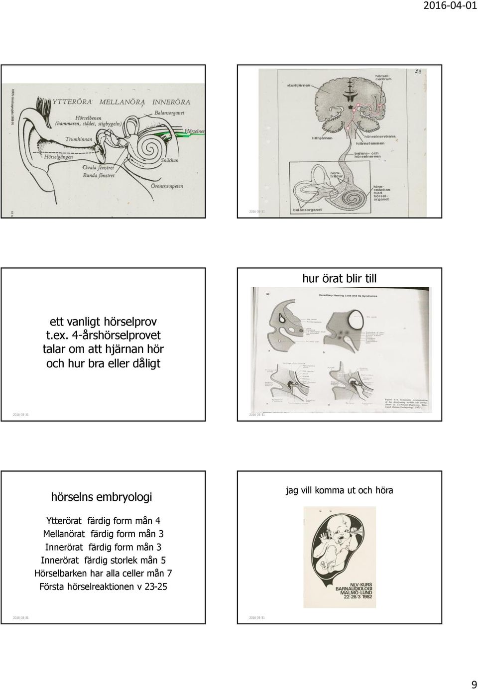 embryologi jag vill komma ut och höra Ytterörat färdig form mån 4 Mellanörat färdig