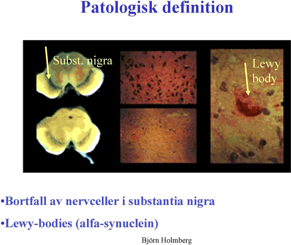 nervceller i substantia