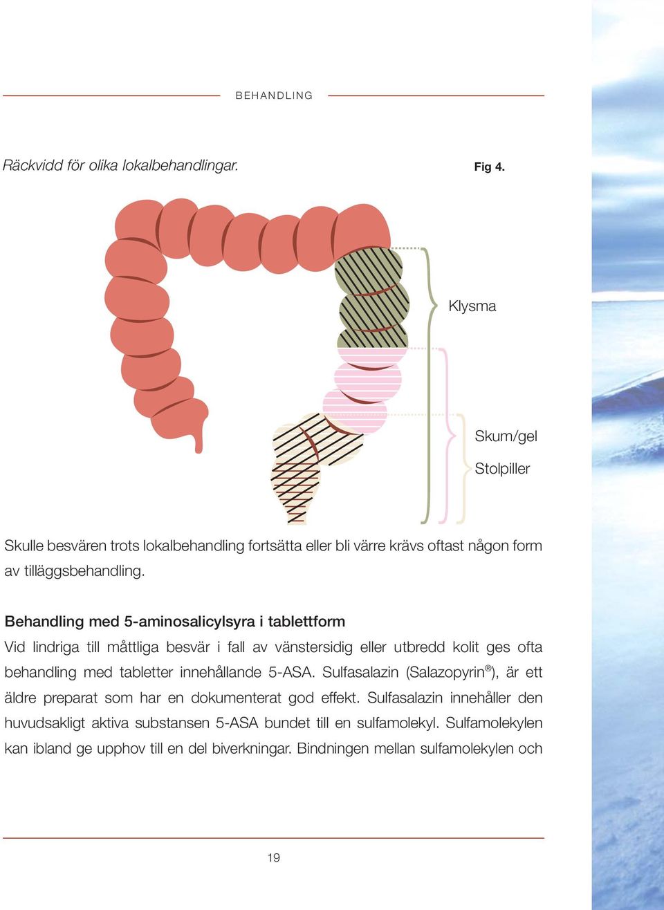 Behandling med 5-aminosalicylsyra i tablettform Vid lindriga till måttliga besvär i fall av vänstersidig eller utbredd kolit ges ofta behandling med tabletter