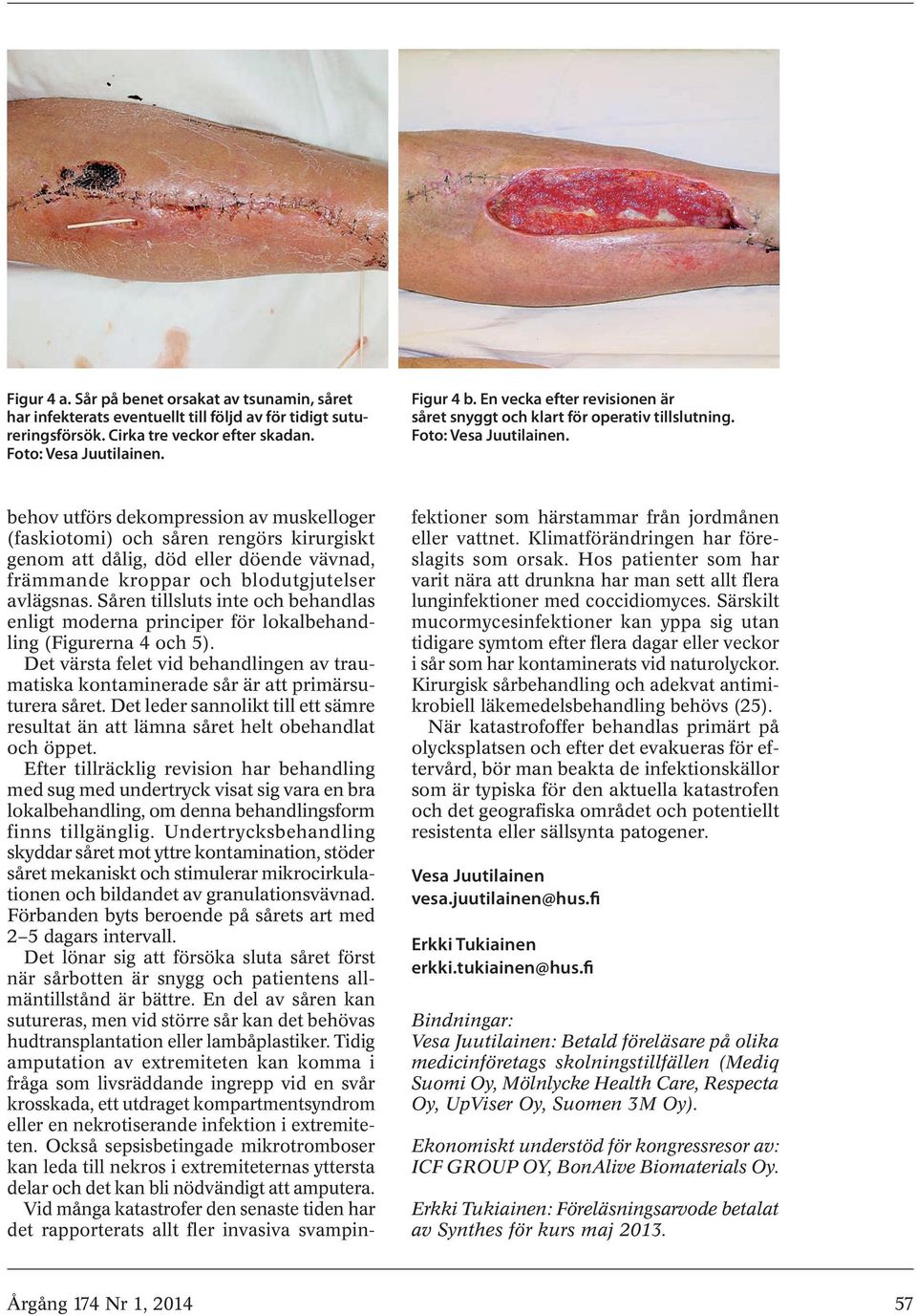 behov utförs dekompression av muskelloger (faskiotomi) och såren rengörs kirurgiskt genom att dålig, död eller döende vävnad, främmande kroppar och blodutgjutelser avlägsnas.