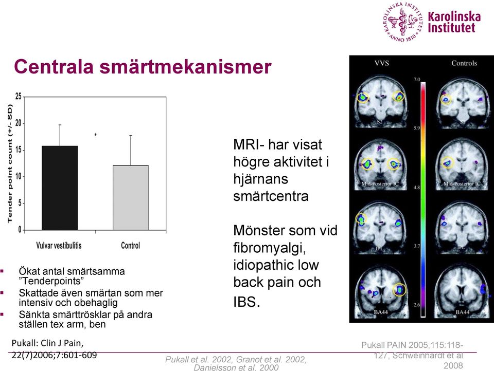 arm, ben Pukall: Clin J Pain, 22(7)2006;7:601-609 Mönster som vid fibromyalgi, idiopathic low back pain och