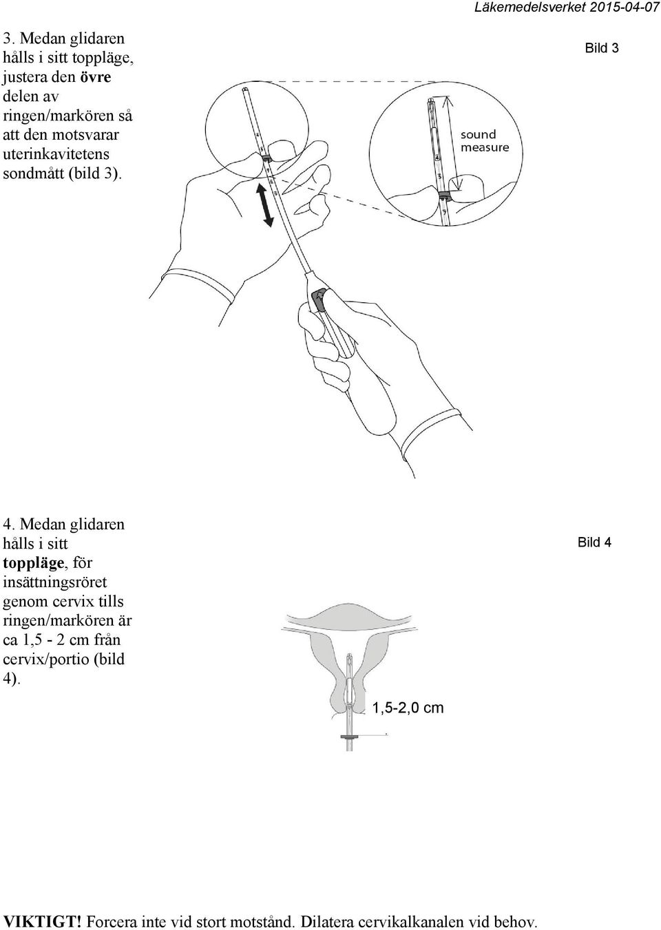 Medan glidaren hålls i sitt toppläge, för insättningsröret genom cervix tills ringen/markören