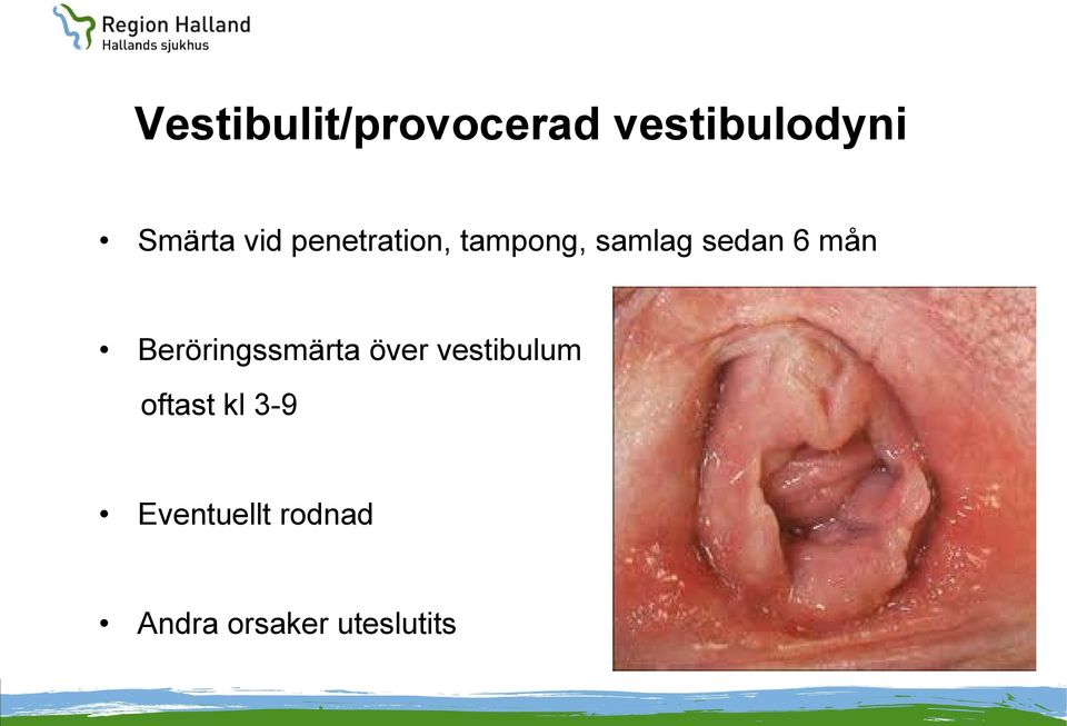 mån Beröringssmärta över vestibulum oftast